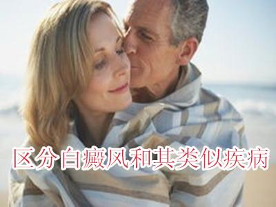 哪些疾病病容易和白癜风混淆呢?