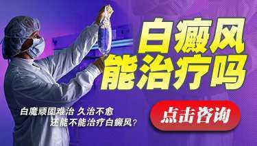 白癜风能治愈吗?