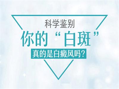 白癜风白斑的颜色有哪些?