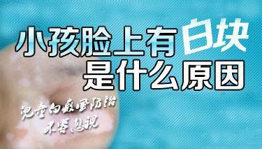 儿童怎样确诊白癜风呢?怎样诊疗呢?