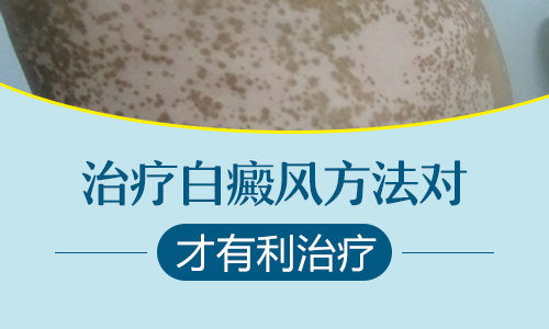 杭州白癜风医院治疗哪个好 发生在唇部的白癜风该如何护理